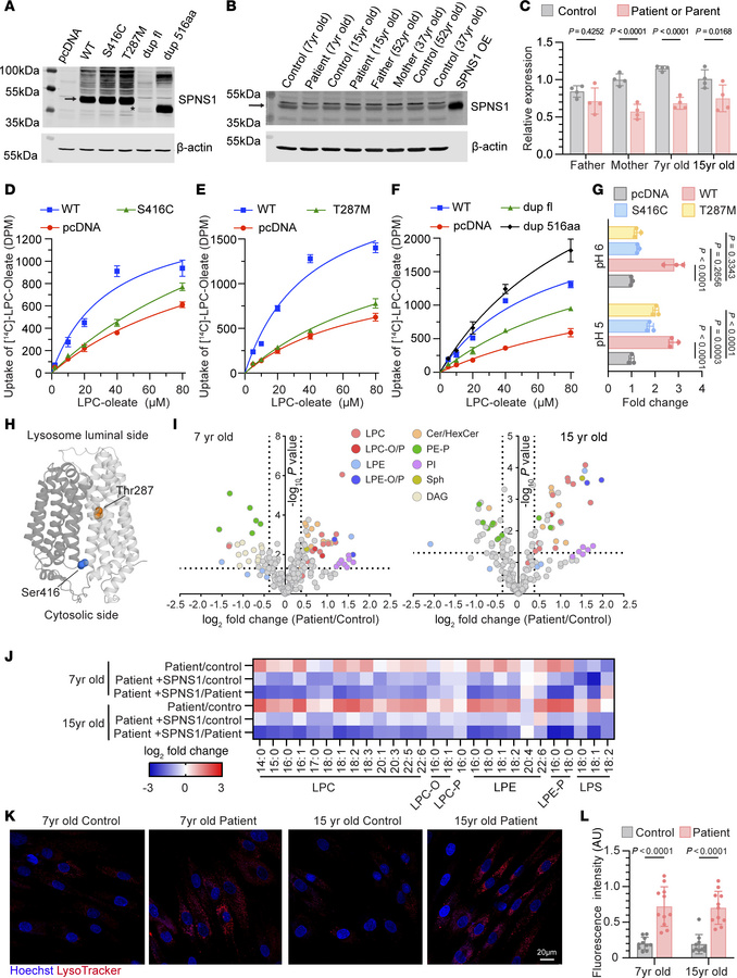 Characterization of SPNS1 mutations identified in patients.
(A) Immunobl...