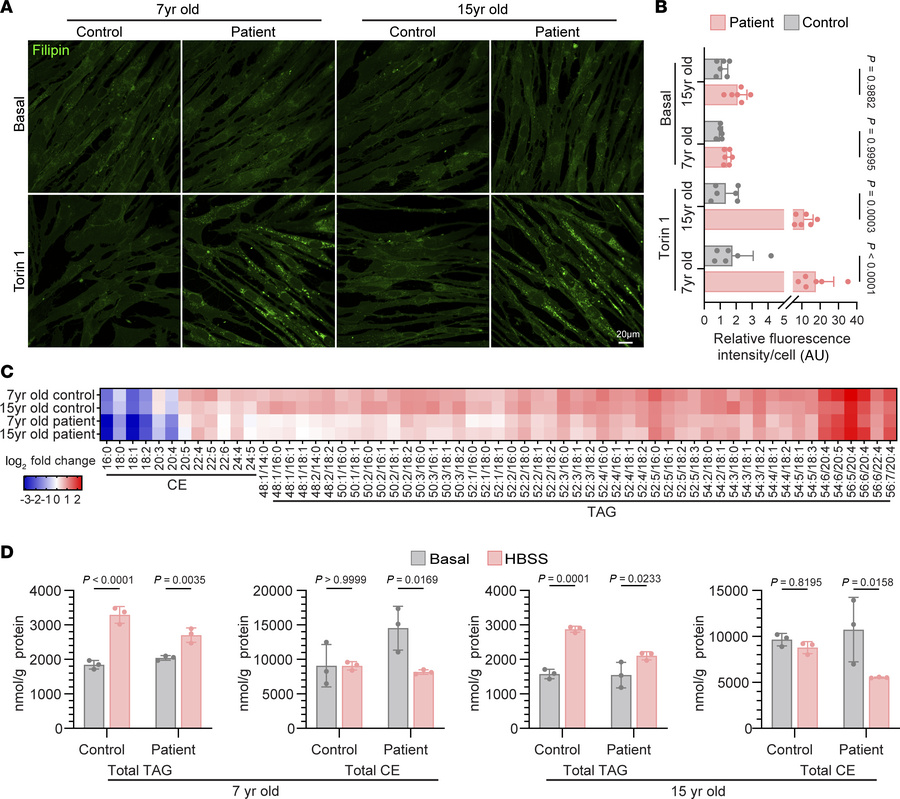 Fibroblasts from SPNS1 patients have increased cholesterol and reduced n...