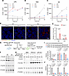 SPNS1 deficiency results in a defect in triglyceride and cholesteryl ester