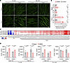 Fibroblasts from SPNS1 patients have increased cholesterol and reduced neut