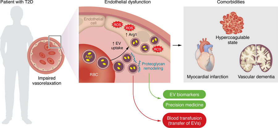 RBC-derived EVs cause endothelial dysfunction in diabetes.
EVs derived f...