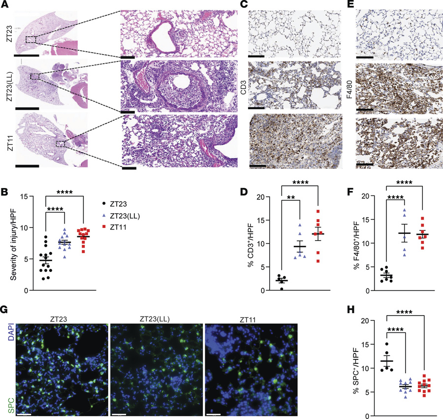 Immunopathology from IAV is worsened by environmental light cycling disr...
