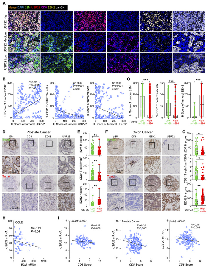 Analysis of USP22/EZH2/b2M expression in multiple types of cancers.
(A) ...