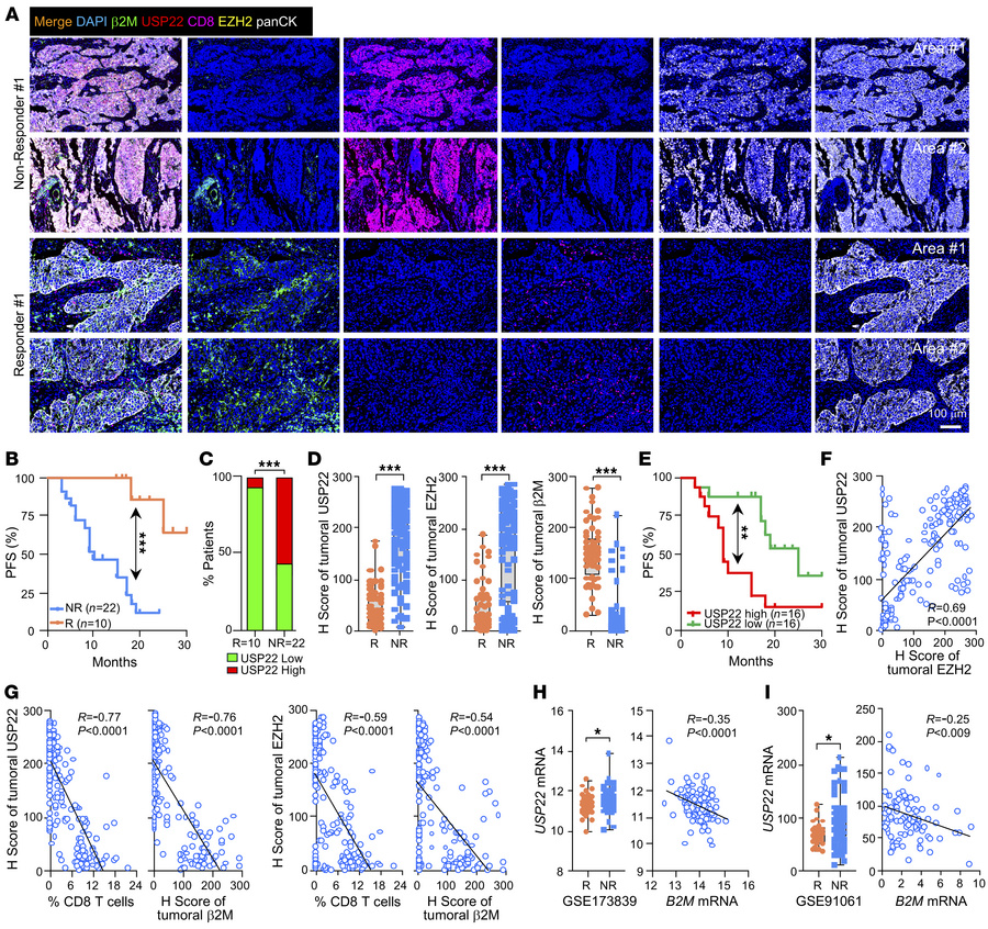 USP22 expression links with ICB resistance.
(A) Representative images of...