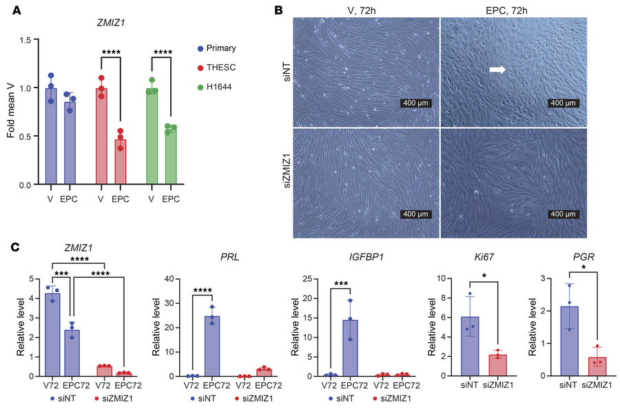 Endometrial stroma decidual response is ZMIZ1 dependent.
(A) ZMIZ1 expre...