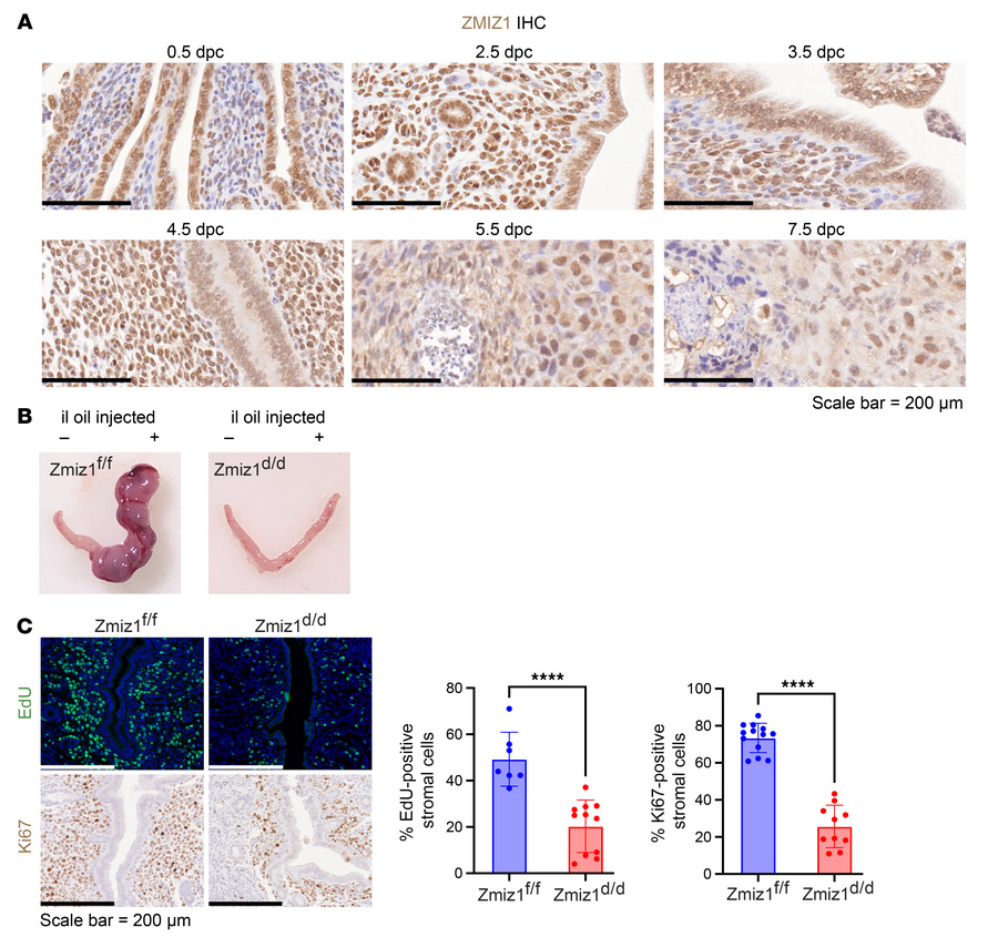 ZMIZ1 modulates proliferative-decidual switching of mouse uterine stroma...