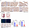 ZMIZ1 modulates proliferative-decidual switching of mouse uterine stromal c
