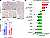 ZMIZ1 Modulates progesterone receptor expression of mouse uterine cells.