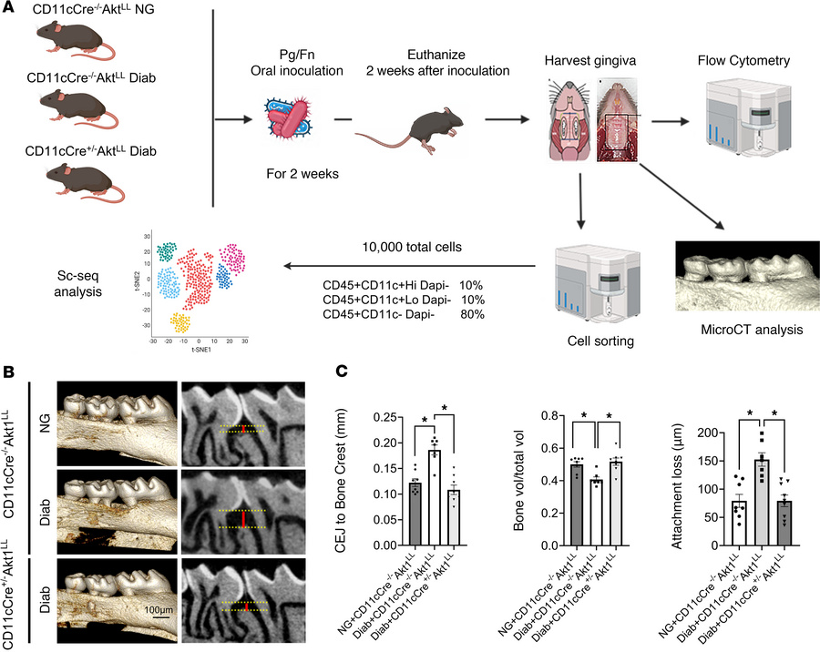 DC-specific AKT1 deletion reverses diabetes-induced periodontal bone los...