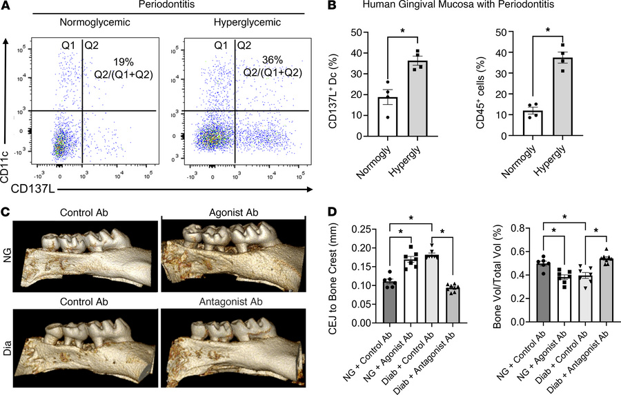 The CD137L-CD137 axis plays a key role in periodontitis severity in hype...