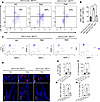 Diabetes increases proliferation and IL7A expression in γδ T cells that are