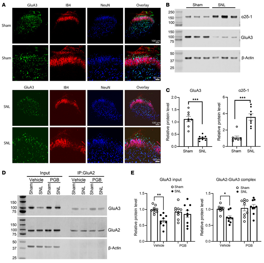Pregabalin blocks nerve injury–induced reduction in GluA3 and GluA2/GluA...