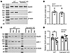 Role of α2δ-1 in nerve injury–induced reduction of GluA3 protein levels in