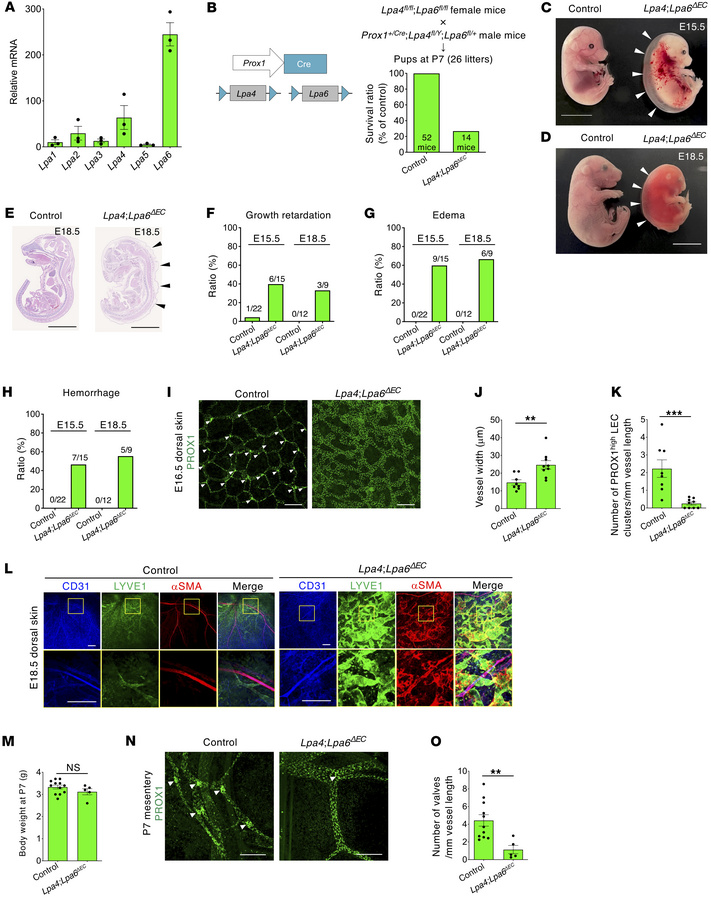 Mice deficient in lymphatic endothelial Lpa4 and Lpa6 exhibit severe ede...