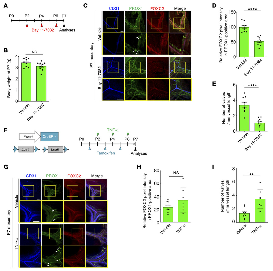 NF-κB activation increases FOXC2 expression and lymphatic valve number i...