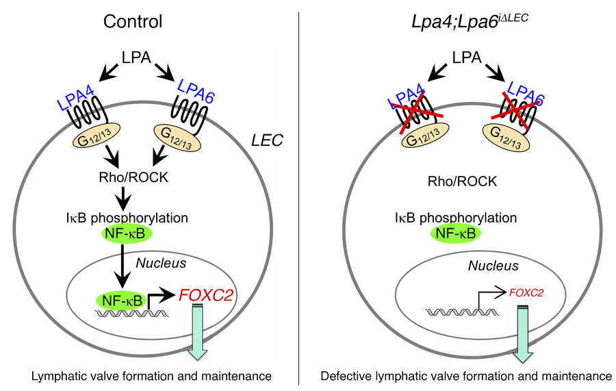 Schematic of the lymphatic endothelial LPA signaling pathway in lymphati...