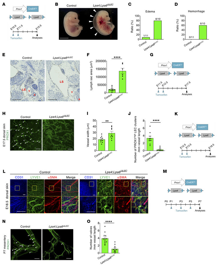 Lymphatic endothelial LPA4/LPA6 are essential for lymphatic valve format...
