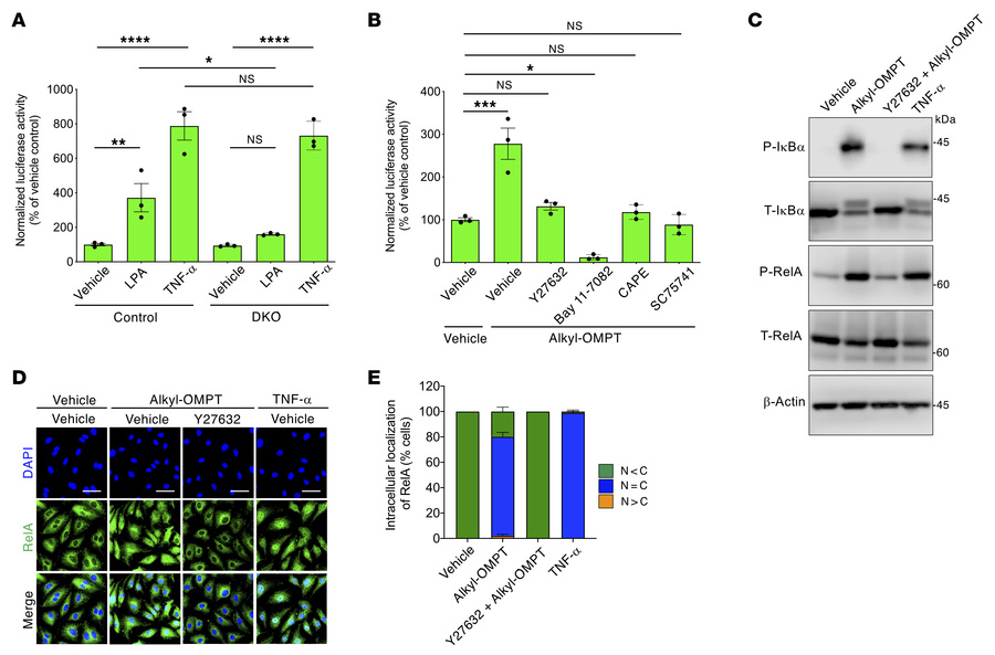 LPA4/LPA6 signaling activates NF-κB through ROCK in LECs.
(A) Increased ...