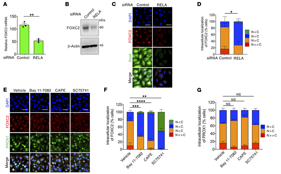 Impaired NF-κB signaling reduces nuclear FOXC2 expression in LECs.
(A an...