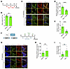NF-κB activation increases FOXC2 expression and lymphatic valve number in n