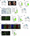 Lymphatic endothelial LPA4/LPA6 are essential for lymphatic valve formation