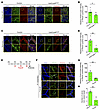 LEC-specific Lpa4/Lpa6 deletion reduces FOXC2 expression in lymphatic vesse