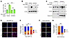 LPA4/LPA6 activation increases FOXC2 nuclear expression in LECs.