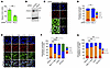 Impaired NF-κB signaling reduces nuclear FOXC2 expression in LECs.