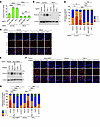 LPA4/LPA6 signaling-induced NF-κB activation promotes FOXC2 expression in L