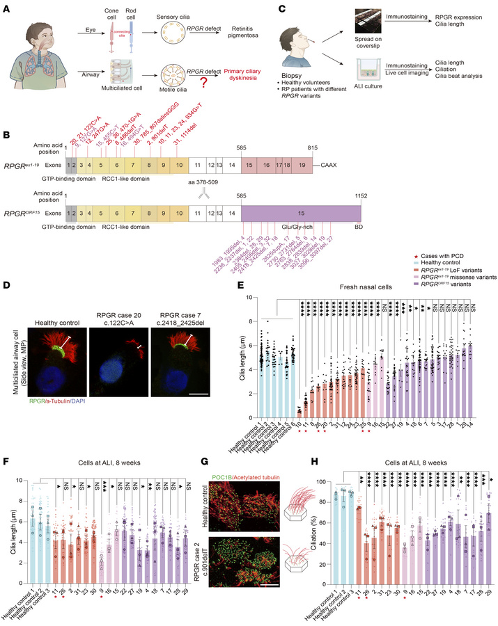 MCCs with pathological RPGR variants presented with short cilia and decr...