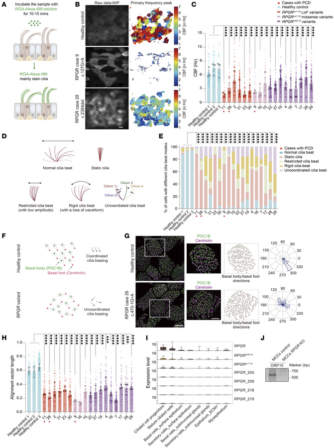 MCCs with RPGR pathological variants had an impaired and uncoordinated c...