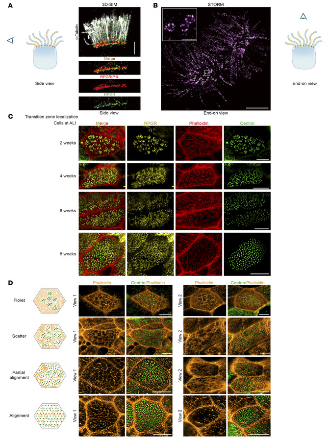 RPGR mainly localized to the TZ and cilia membrane; the relative distrib...