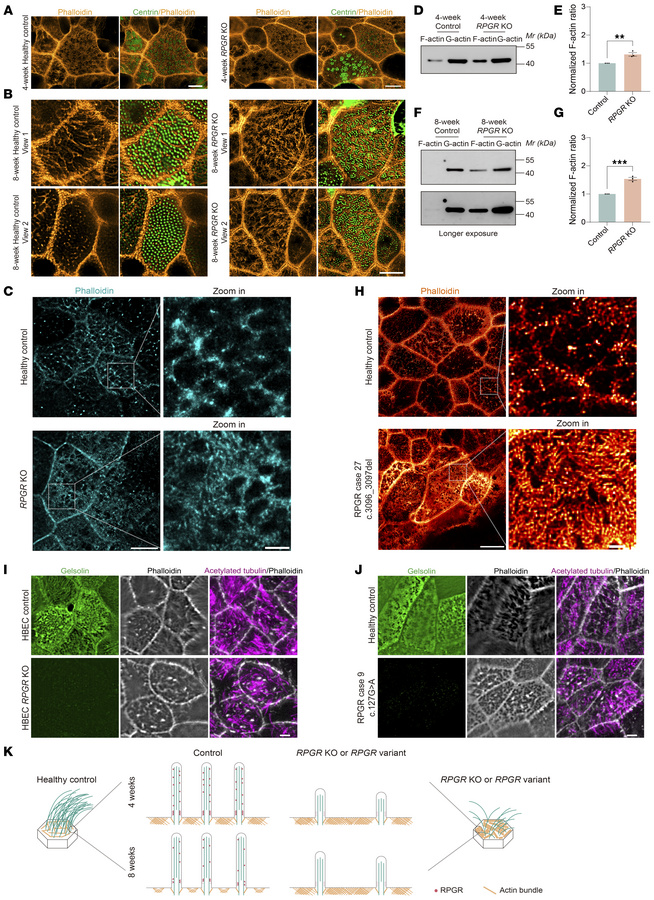 Mature RPGR LoF MCCs presented with condensed apical F-actin meshwork th...
