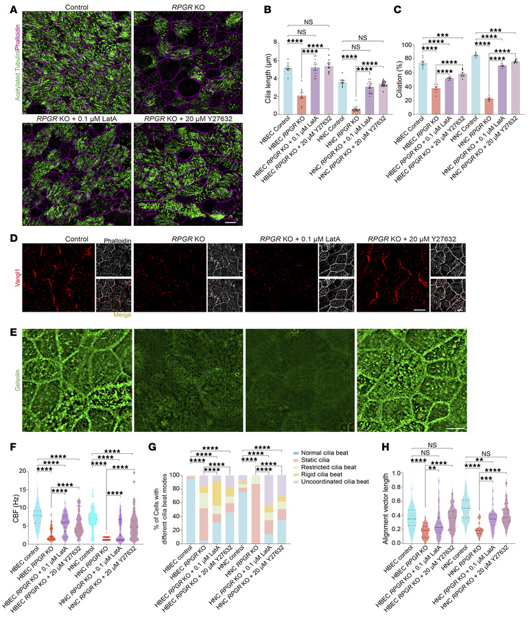 LatA and Y27632 treatment ameliorated the motile cilia defect in RPGR KO...