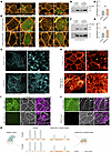 Mature RPGR LoF MCCs presented with condensed apical F-actin meshwork that