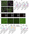 LatA and Y27632 treatment ameliorated the motile cilia defect in RPGR KO MC