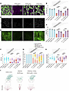 LatA and Y27632 treatment ameliorated the motile cilia defect in patient MC