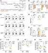 Macrophages suppress the UMP salvage pathway in tumor cells.