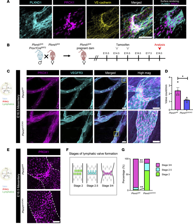 LEC Plxnd1 is indispensable for lymphatic valve development.
(A) Whole-m...