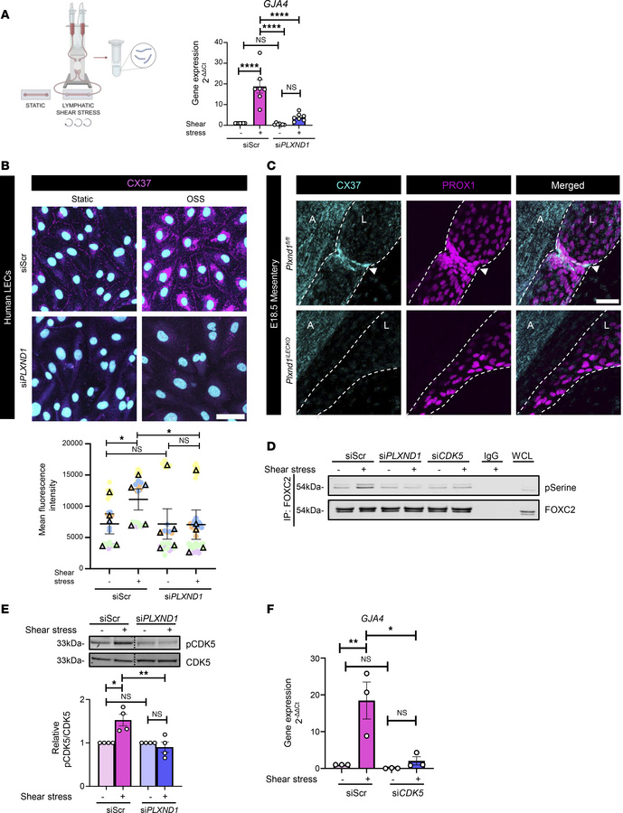 PLXND1 regulates the lymphatic valve program via an unconventional pathw...