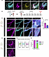 LEC Plxnd1 is indispensable for lymphatic valve development.