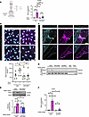 PLXND1 regulates the lymphatic valve program via an unconventional pathway.