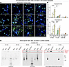 The neurotoxicity of Aβ42 and Aβ42arctic correlates with their aggregation