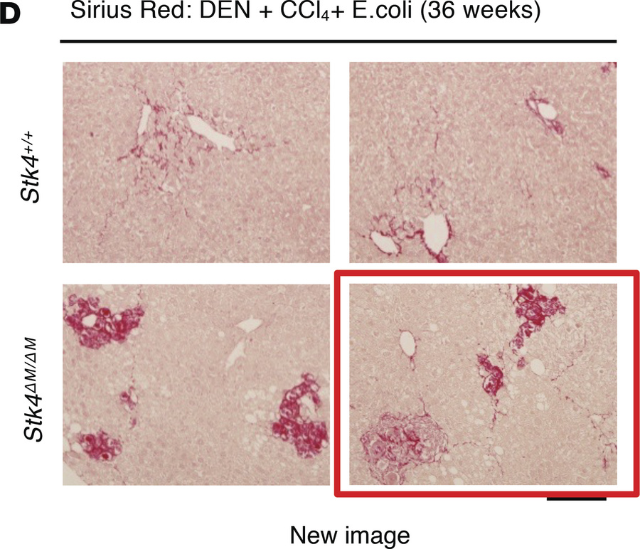 STK4 protects mice from DEN and bacterial infection-induced HCC in vivo.