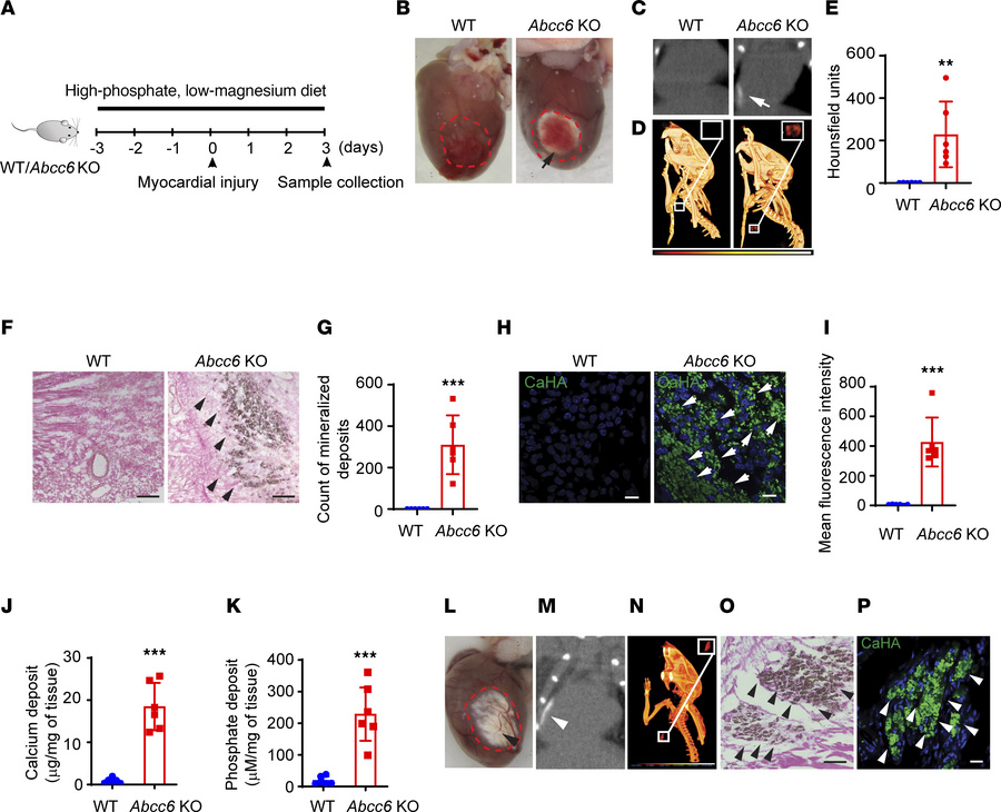 Genetic deletion of Abcc6 leads to persistent myocardial calcification a...