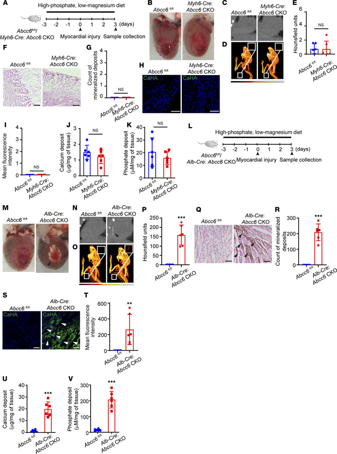 Liver- but not cardiac muscle–specific deletion of Abcc6 leads to ectopi...