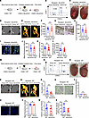 Bone marrow–derived cells do not affect ectopic cardiac calcification.