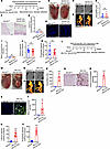 Liver- but not cardiac muscle–specific deletion of Abcc6 leads to ectopic c