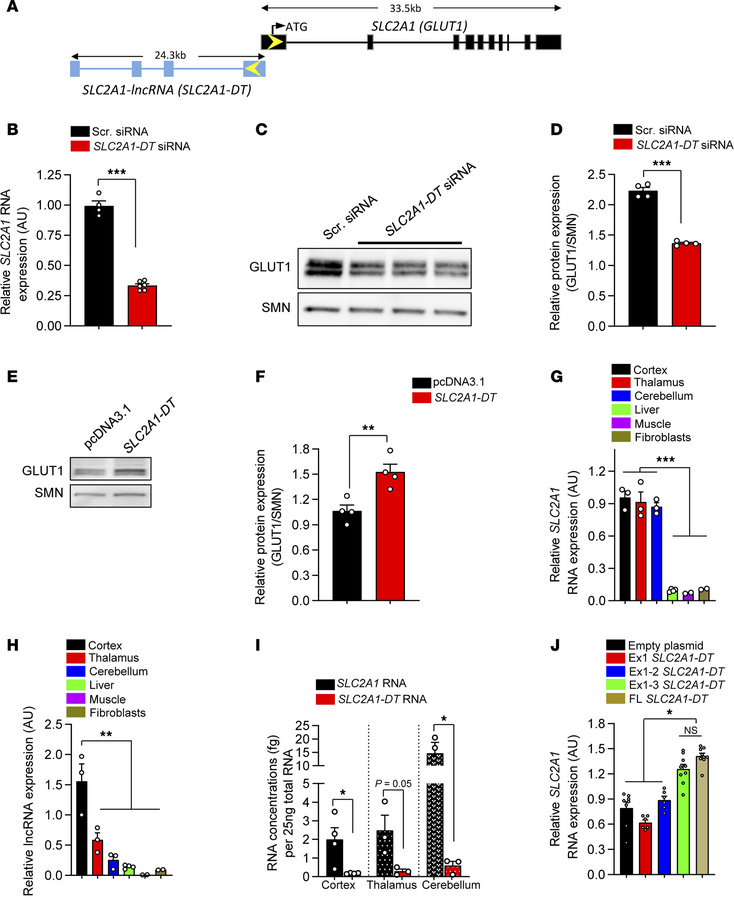 A natural antisense transcript regulates SLC2A1/GLUT1 expression concord...