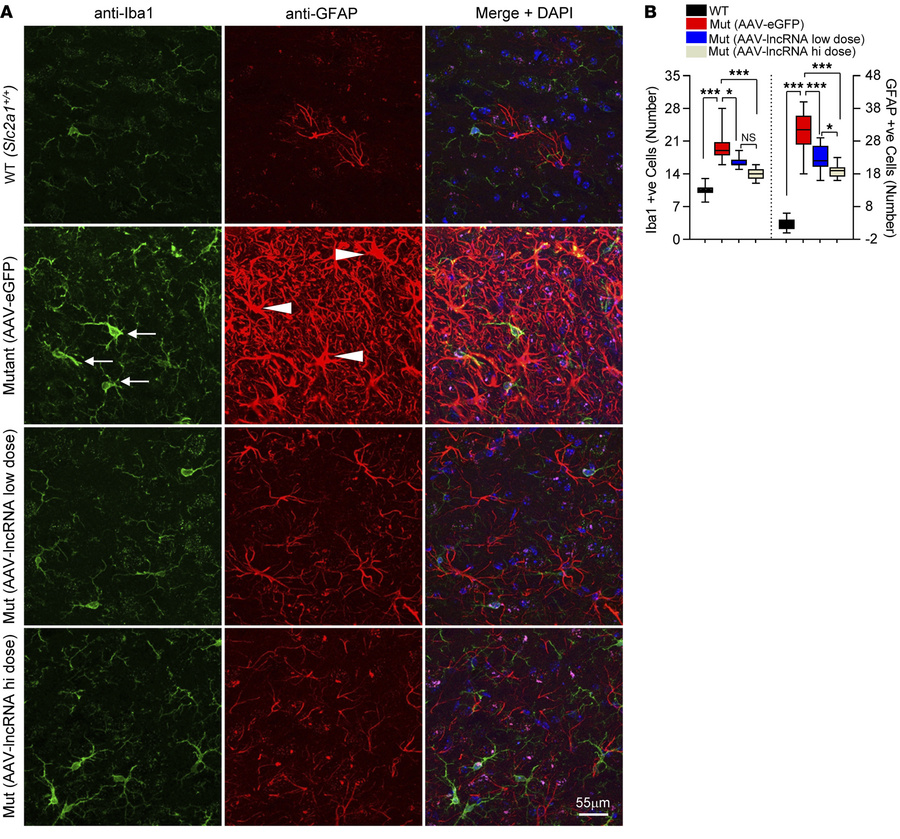 AAV-mediated delivery of the SLC2A1-DT lncRNA reduces neuroinflammation ...